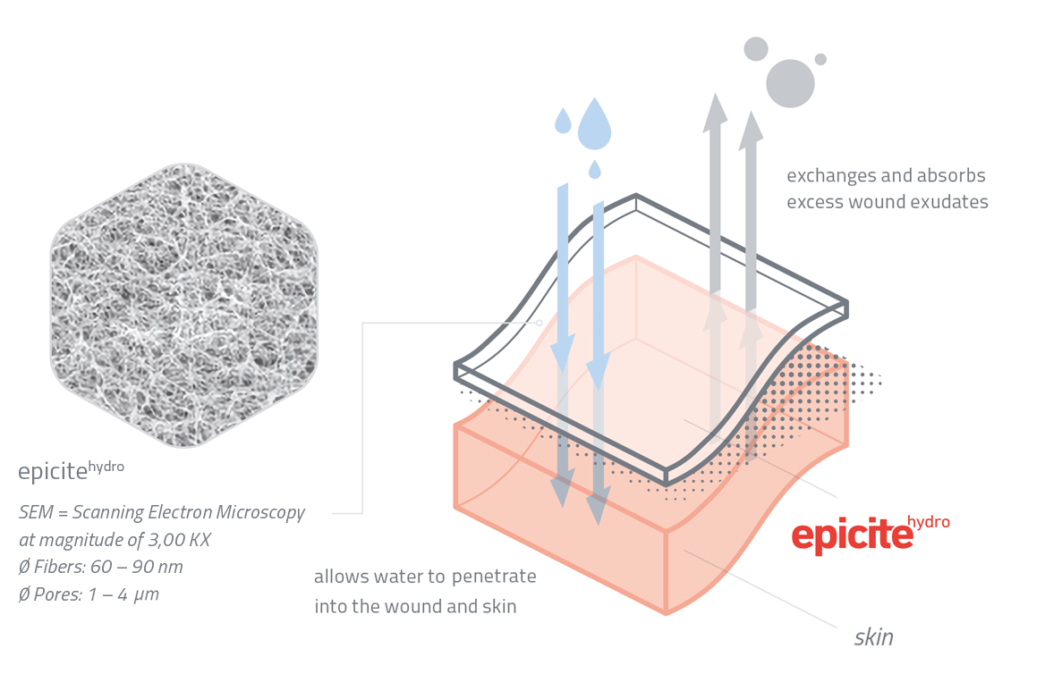 grafik_epicitehydro-1-en-3